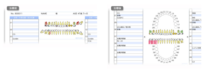 診療ユニットチェア