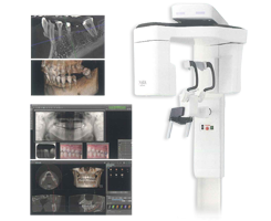 歯科用CT完備